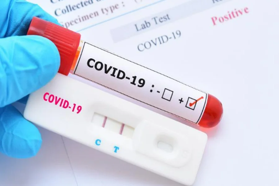 Trusted COVID Testing Services You Can Rely On COVID Testing