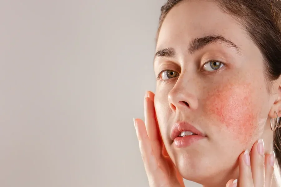 Understanding Common Skin Concerns and Their Treatment Options